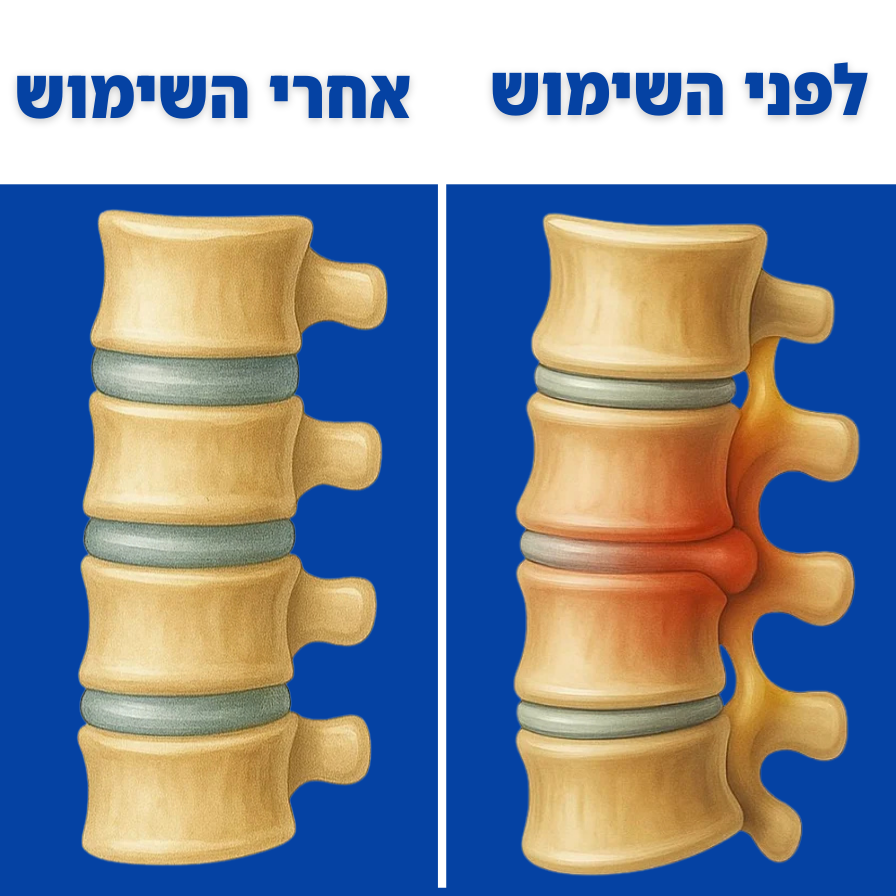 FreeBack - כרית טיפולית לגב